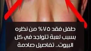 طفل يفقد 75% من بصره بسبب "لعبة منزلية شهيرة"! الصورة تكشف الكارثة!