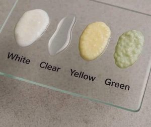 أنواع افراز.ات المهب.ل و ماذا تعني كل واحد…